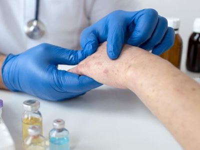 Alerta epidemiológica por un nuevo caso de sarampión en Entre Ríos