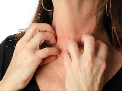 Alergia emocional: cuando el cuerpo reacciona con síntomas físicos a situaciones afectivas