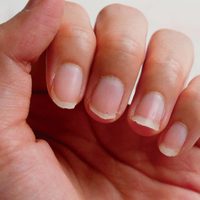 Nail Art: con 1 ingrediente de la cocina, mirá este truco de las abuelas para decirle adiós a las uñas quebradizas