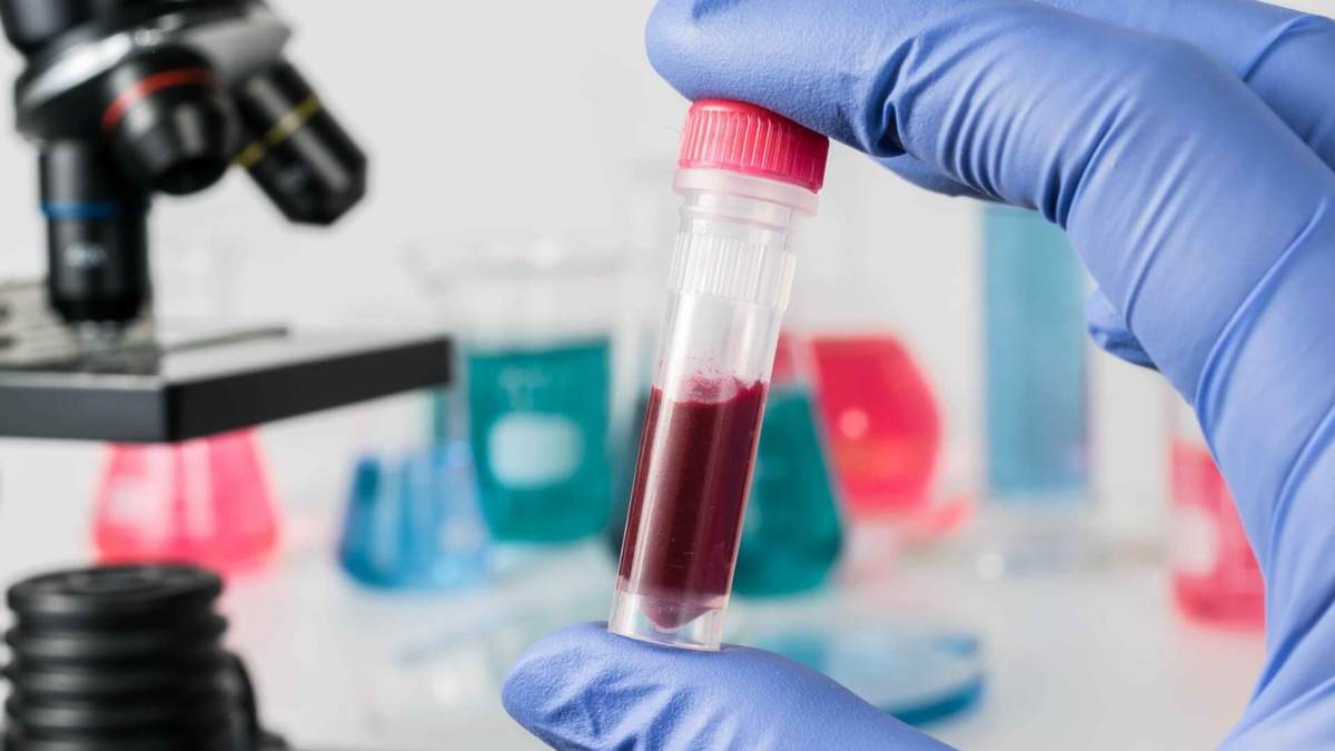 Podría haber una relación entre el grupo sanguíneo y las posibilidades de contraer coronavirus de un modo leve. Fuente: (Twitter)