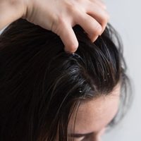 El secreto para eliminar la caspa de tu cabello en tiempo récord y sin gastar una fortuna