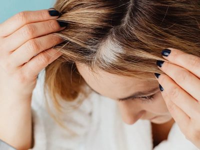 3 veces a la semana es suficiente: probá este poderoso remedio para cubrir las canas en poco tiempo