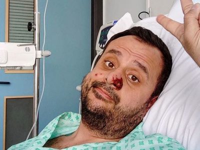¿Por qué la viruela del mono es nuevamente una emergencia y hasta qué punto debería preocupar?