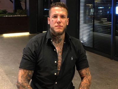 "Tremendo": el retoque estético al que se sometió Alex Cannigia