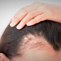 Sin gastar en keratina o tratamientos: prepará este tónico para el cabello, para fortalecerlo y reducir su caída