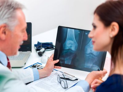 Tomá nota: los alimentos que fortalecerán tus huesos, suman calcio y evitan la osteoporosis