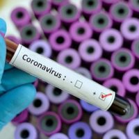 ¡Preocupación en Choele Choel! 4 empleados de un supermercado tienen coronavirus