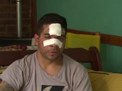 Denunció un "robo piraña" pero en realidad se cayó de su bicicleta