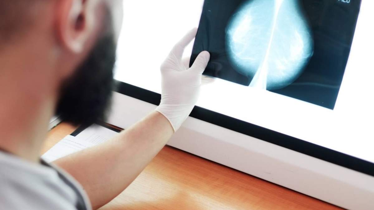 Cáncer de mama