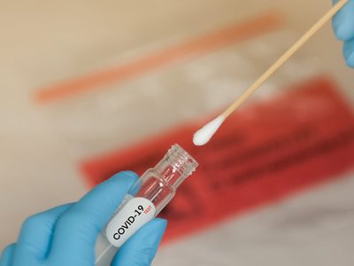 Laboratorio de La Matanza realiza hisopados en tiempo récord