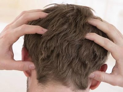 Chau a la caspa: no gastes más en productos caros y aplicá en tu cabello esta receta de la abuela que no falla