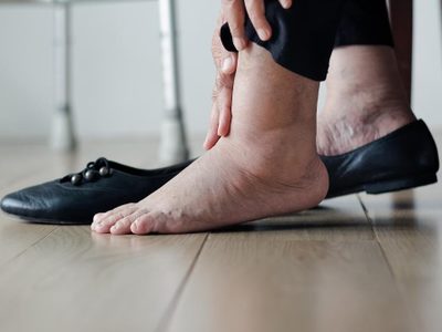 No alcanza con levantar las piernas: el truco para evitar los pies hinchados a partir de los 60 años