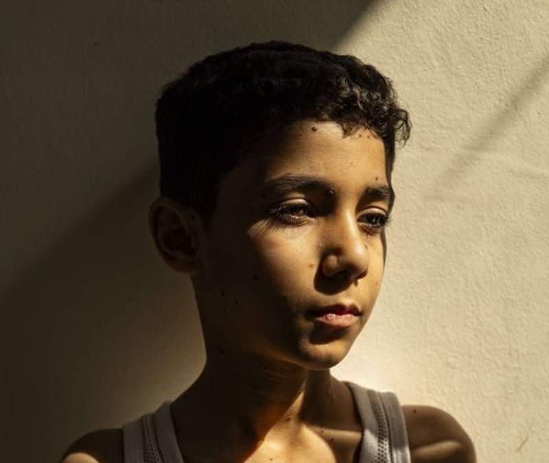 Imagen de un joven palestino que perdió los dos brazos en un ataque israelí en Gaza, ganadora del World Press Photo?