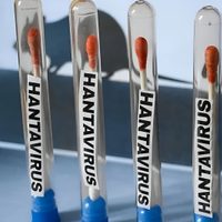Chubut confirmó un caso de hantavirus en medio del temor mundial por el brote