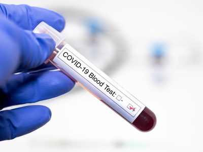 Confirmado: importante figura política de Río Negro tiene coronavirus