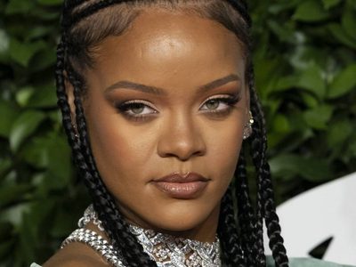 ¿Cómo se anima? Sale a la luz una foto de Rihanna que preocupó a sus fans ¡Espeluznante!