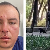 Soy el afectado de la "gente” de Sandra Cuevas: ciudadano golpeado pide ayuda (Videos)