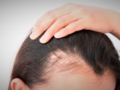 Sin gastar en keratina o tratamientos: prepará este tónico para el cabello, para fortalecerlo y reducir su caída
