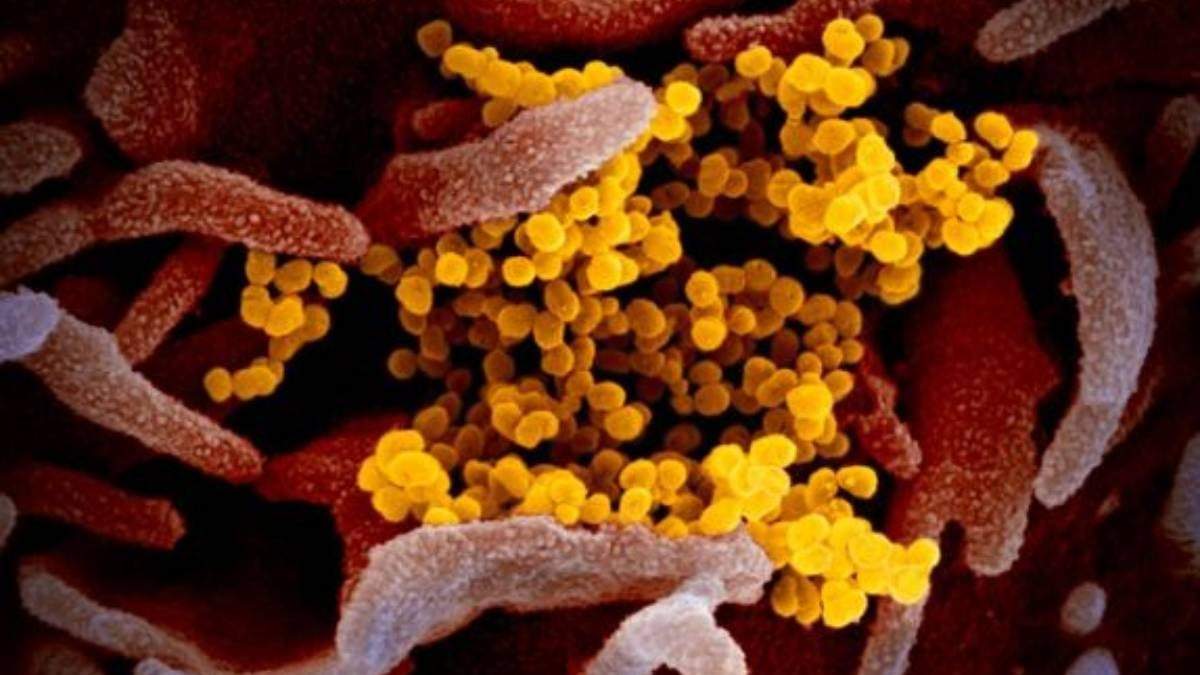 El virus SARS-Cov-2