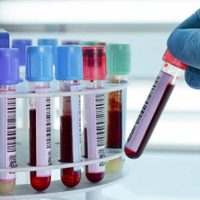 Río Negro registró 301 nuevos casos activos y 7 pacientes fallecidos por coronavirus