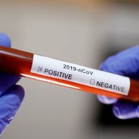 ¡Unieron esfuerzos! Empresas mineras donaron 214.500 kits para combatir el coronavirus