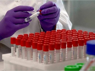 Otorgan un crédito de $30 millones para el desarrollo del suero hiperinmune contra el coronavirus