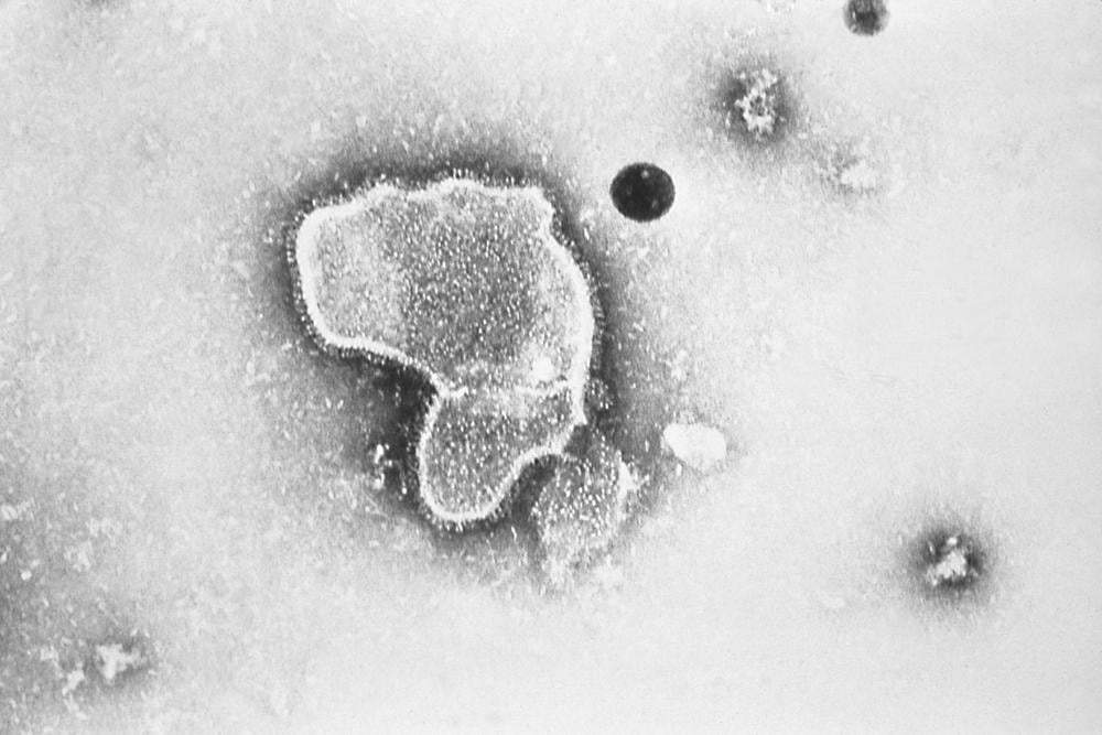 Virus respiratorio sincitial. Imagen de 1981 cortesía de los Centros para el Control y la Prevención de Enfermedades de EU
