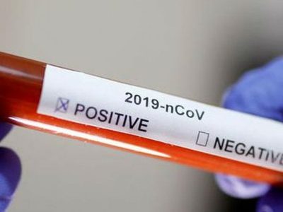 Coronavirus: ¿Positivo o negativo? El por qué los estudios arrojan distintos resultados...