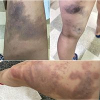 Judo en Jalisco: el maltrato oculto detrás de los triunfos