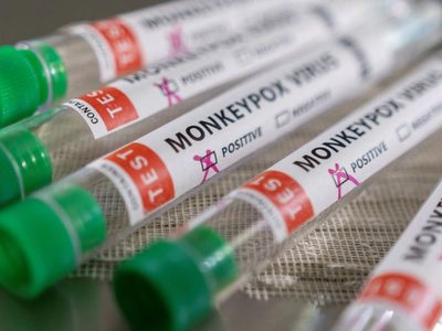 Aumentan los casos de viruela del mono en países no endémicos: la OMS actualizó la cifra