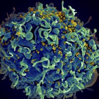Descubren una variante del VIH más contagiosa y virulenta