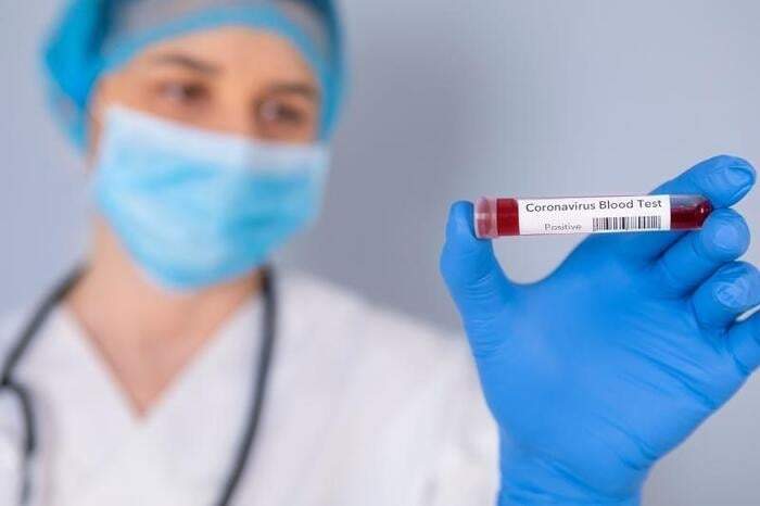 Nuevo caso confirmado de coronavirus en la provincia de Neuquén. Fuente: (Twitter)