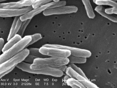 Repunta la tuberculosis: en 2023 alcanza la cifra de casos más alta en una década