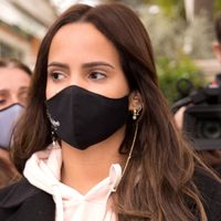 Gloria Camila se somete a un tratamiento estético que modifica una parte de su rostro