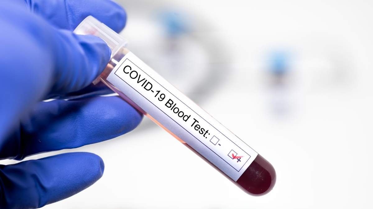 Coronavirus. Fuente: (Twitter)