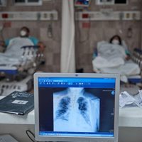 Anticuerpos sabotean el sistema inmune en pacientes graves de covid-19: Science