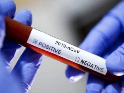 Desde el Gobierno de Río Negro, esperarían un rebrote de contagios de coronavirus
