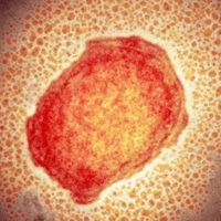 Viruela del mono: qué es, cuáles son sus síntomas y cómo se transmite