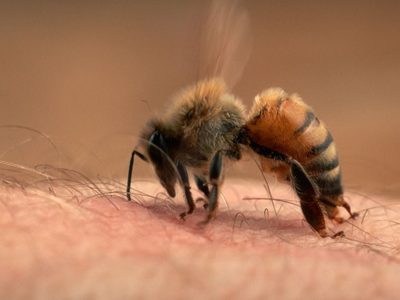 No sufras más: el remedio casero de las abuelas para aliviar las picaduras de abeja en solo unos minutos