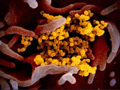 Variante británica del coronavirus “va a barrer el mundo, con toda probabilidad”: Genomics UK