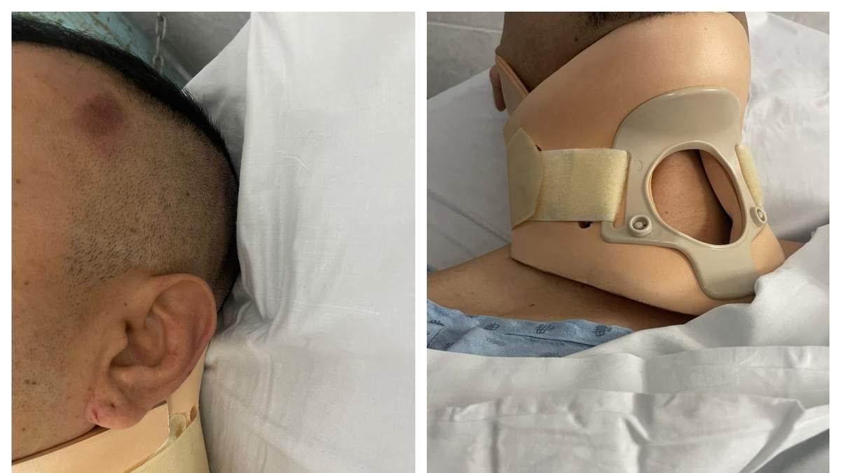 Mako Sierra fue trasladado al hospital comunitario de Juventino Rosas