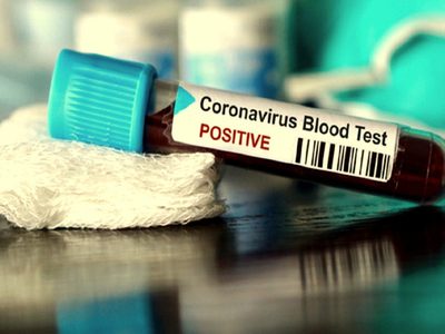 Preocupante: una localidad rionegrina tuvo 5 casos de coronavirus en un día