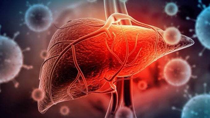 Hepatitis