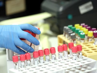 ¡Gran avance! Científicos argentinos crearon un test que detecta al virus del dengue en minutos