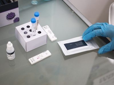 El número de casos de covid-19 en Europa baja 22% en la última semana de julio
