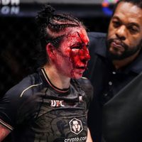 Irene Aldana sufre espeluznante corte en su rostro durante su pelea en la UFC (Video)