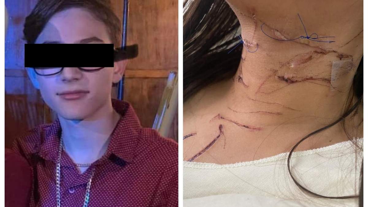 Erik "N" y las heridas causadas a Mya
