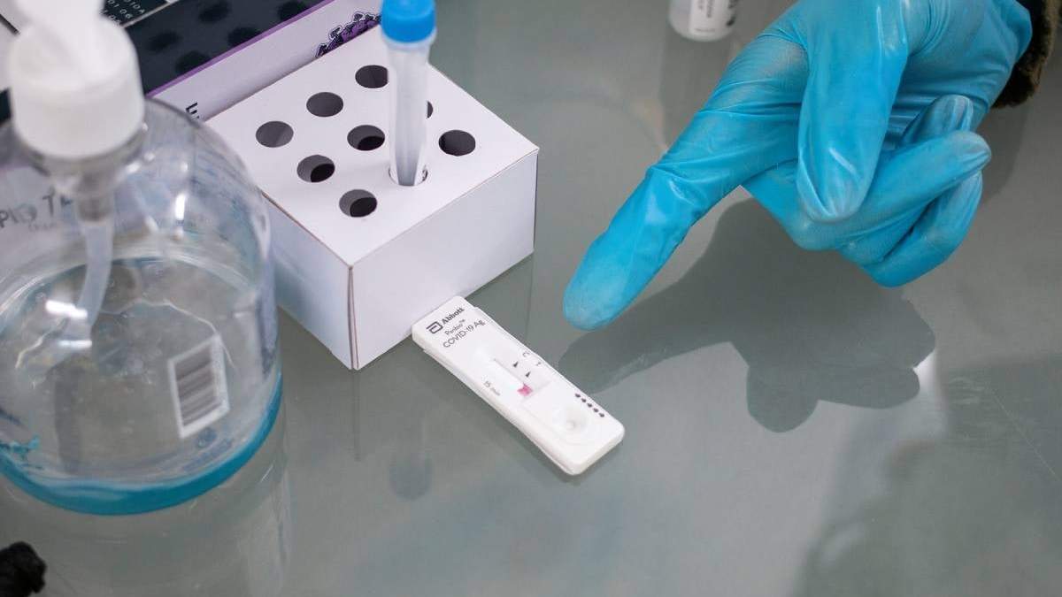 Análisis de muestras de coronavirus