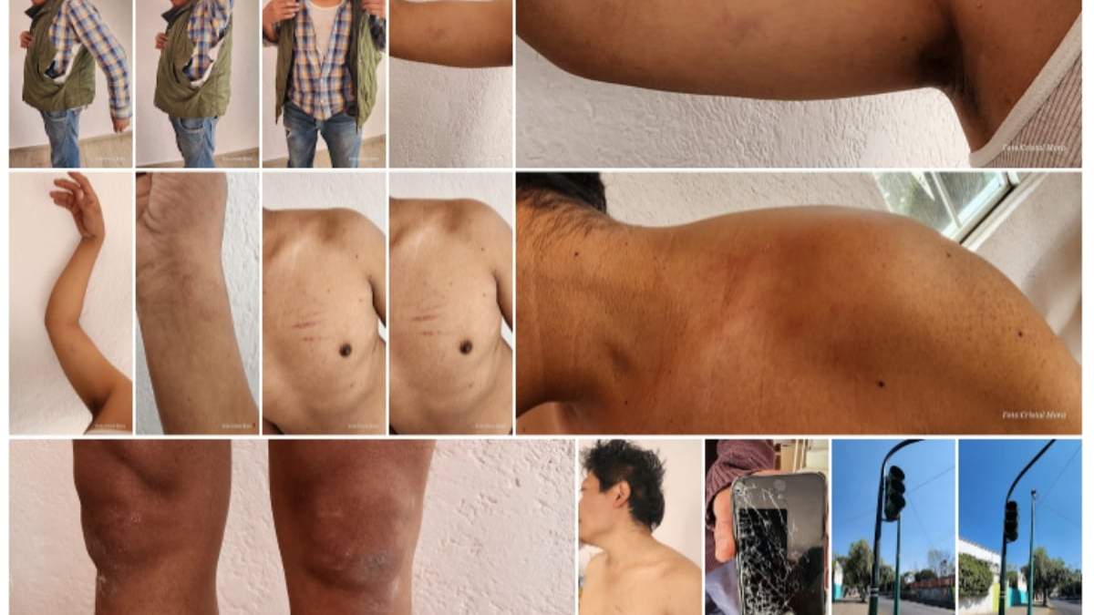 Las marcas de los golpes