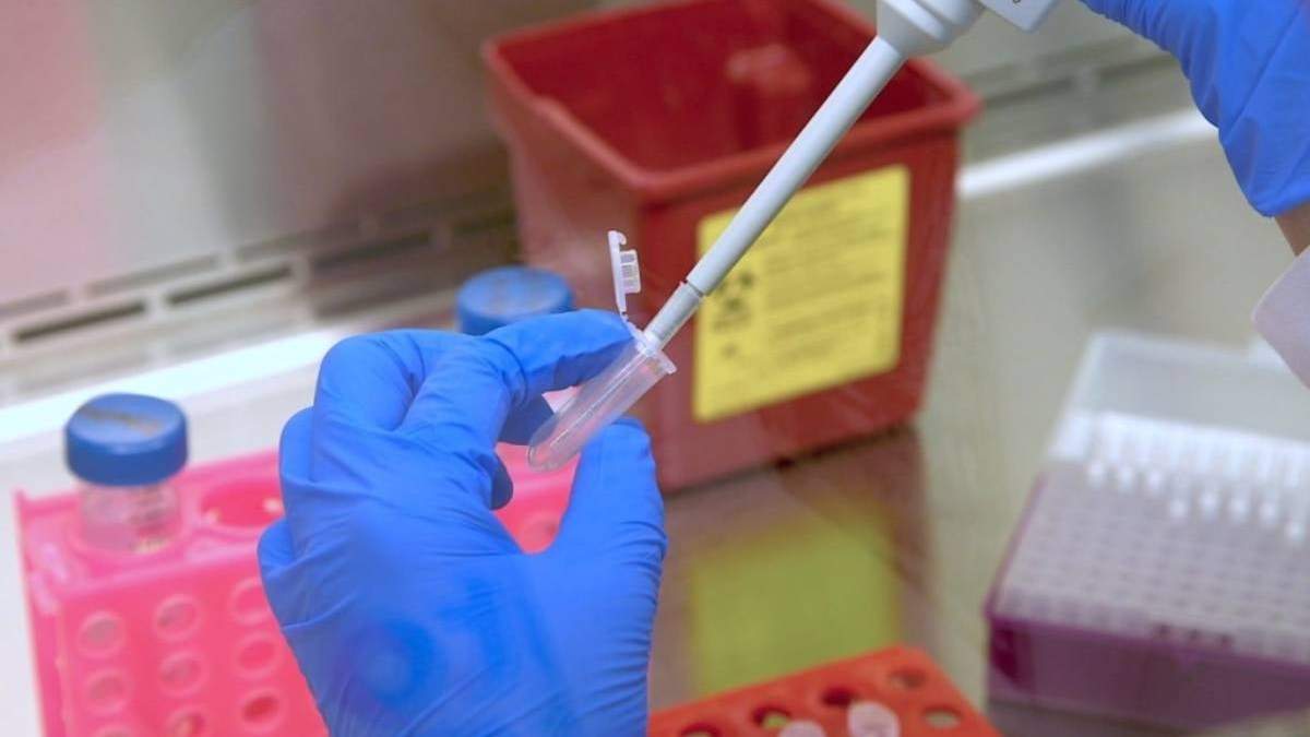 Los pacientes que presentaron la variante son originarios de León